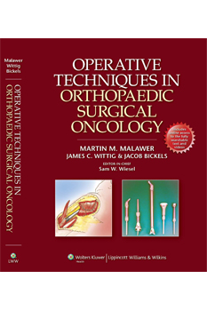 宅配 医学書 Wikiwand 医学- Orthopaedic Surgical Oncology - www