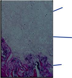 Cells in Lacunae; Ground Glass Hyaline Cartilage Matrix, Zone of Hypertrophy, Zone of Provisional Calcification; Enchondral Ossification