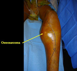 INTRAOPERATIVE IMAGES, Incision